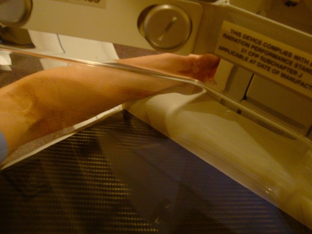 does my mammogram makeup look ok